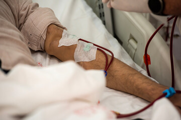 Close-up image of dialysis patients receiving treatment for kidney failure