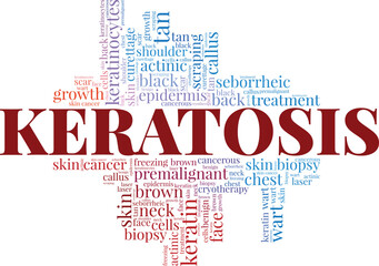 Keratosis word cloud conceptual design isolated on white background.
