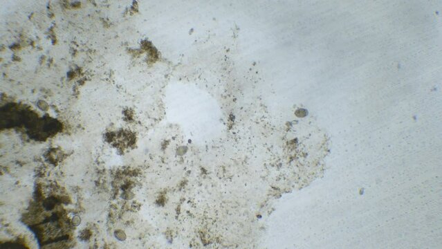 Microscopic life in a water droplet with bacteria, microorganisms, and plants. High magnification shows paramecia and bacteria. Lab study of organic contamination in water.