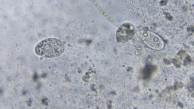 Observing life in a water droplet under a microscope. High magnification reveals bacteria, paramecia, and other microorganisms. Lab study on water organic contamination.