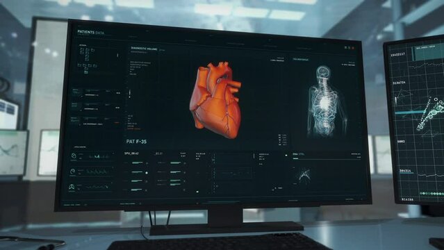 Medical software deals with the heart disease analysis at the laboratory. Analyzing the heart for disease research. Medical system has found cardiac ischemia disease after the thorough heart analysis.