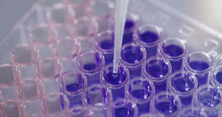 Pipette, liquid and test tube in laboratory for science experiment, chemical analysis and sample...