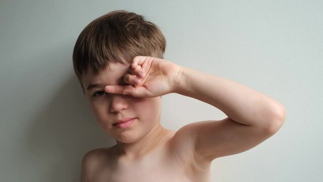 The boy looking at the camera rubbing his swollen eye from an insect bite. Close-up portrait. Angioedema. Allergic response. Red inflamed upper eyelid. Inflammation. Itching bites. The tired child