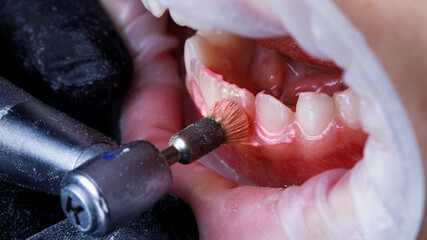 Obraz premium dentist hygienist makes a dental hygienist with a brush on the lower jaw