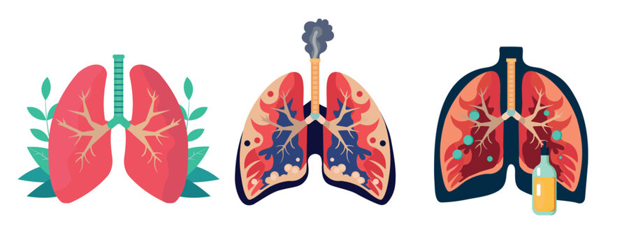 three lung conditions, healthy, affected by cigarettes and alcohol, symbol, on a white background, World Abstinence Day, August 1, fight cancer,