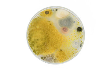 Swab testing. Hygiene test results. Microbial growth on live surfaces.Skin microflora.