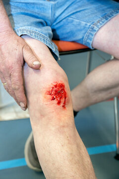 EHBO training met lotusslachtoffers van mensen met een diepe wond met bloed.
