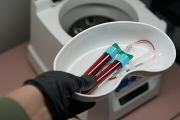 Platelet rich plasma preparation, collected blood, centrifuge, shallow depth of field.