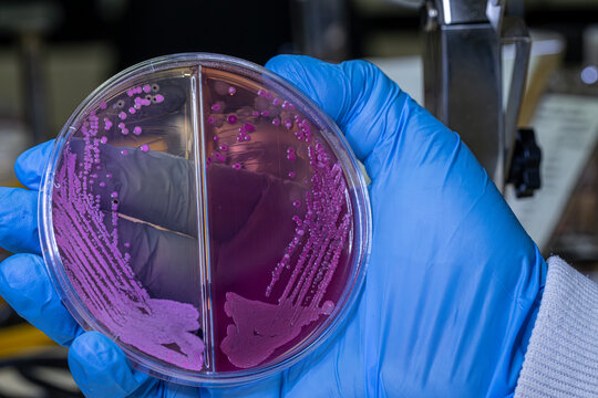 Medical themes: Hand holds a Petri dish with Salmonella bacteria stool culture Sp.