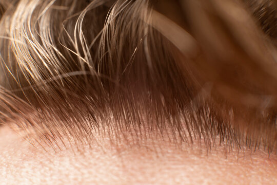 The Hair line on the man forehead - macro close up