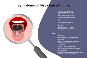 Symptoms of black hairy tongue, medical information  © Oksana