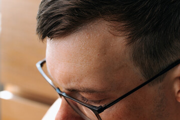 Close-up image of man forehead covered in sweat, showing detail and texture, with a focus on his...