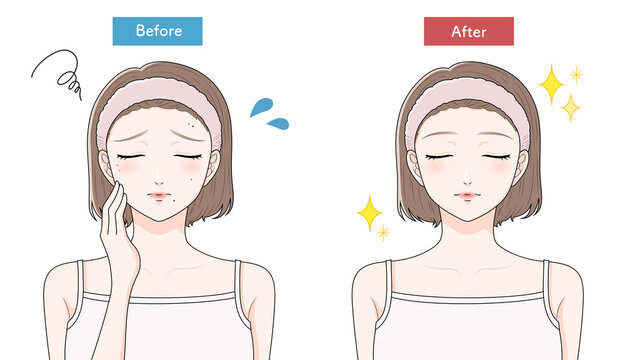 ほくろに悩む女性　ビフォーアフター