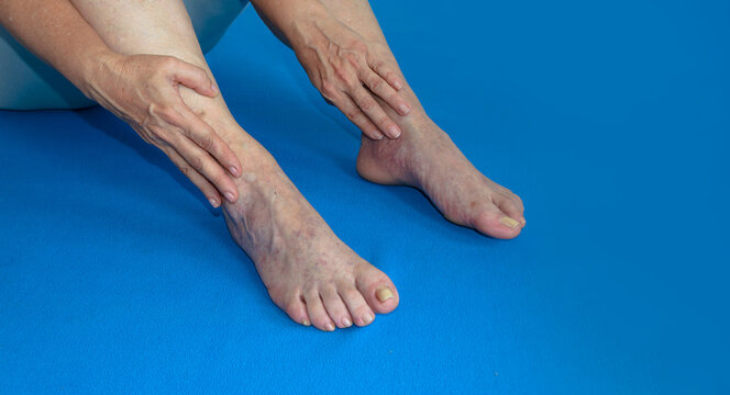 Manos de mujer mayor tocando sus pies. Cuidado de los pies, diagn&oacute;stico, tratamiento y prevenci&oacute;n.