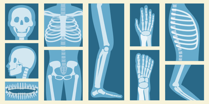 3D Isometric Flat Vector Set of XRay Of Human Body Parts, Skeleton and Bones Scan