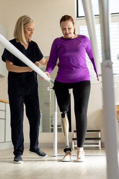 Woman in prosthetic leg walking using parallel bars with therapist assisting