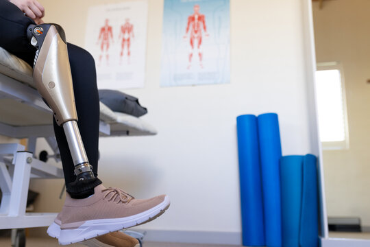 Person with prosthetic leg sitting on medical examination table in clinic, copy space