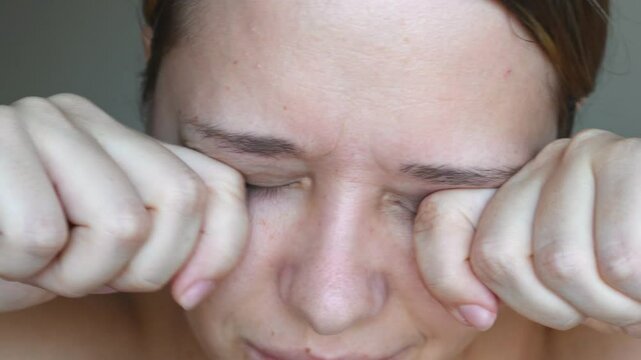 A young caucasian woman scratching her eyes with the hands because of allergies on a grey background. Allergy, itching, rashes, watery eyes. Allergic reaction 