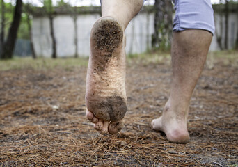 Dirty feet with mud