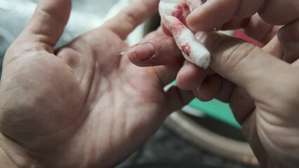 Close-up of a hand with cut finger being treated with a cotton pad to stop the bleeding while washing dishes, highlighting first aid care in everyday kitchen accidents