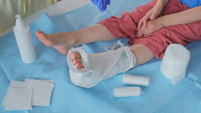 Registered Nurse Pediatritian Doctor Changing Dressing and Removing Medical Plaster Short Leg Orthopedic Cast during Treatment of Broken Ankle Injury of Caucasian Girl