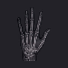Female hand skeleton, x-ray. Isolate.