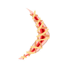 stitch suture cartoon. doctor cut, medical incision, room care stitch suture sign. isolated symbol vector illustration