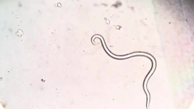 A moving nematode under a microscope.