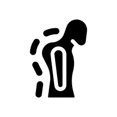 Kyphosis Icon