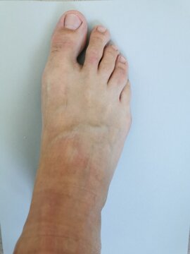 Pied d'homme