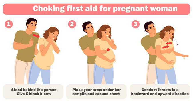 Choking first aid for pregnant woman training infographic poster vector illustration. Detailed instruction to safe life due to blocked swallowing. Correct technique for applying during pregnancy