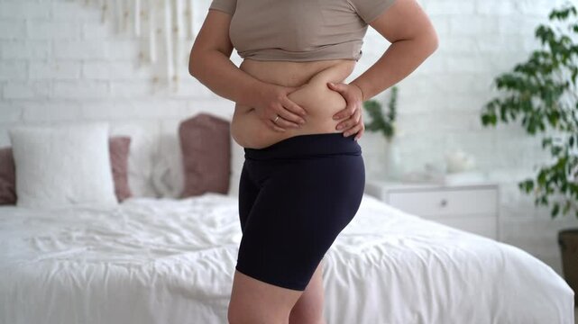 Tummy tuck, flabby skin on a fat belly, plastic surgery and liposuction concept at home