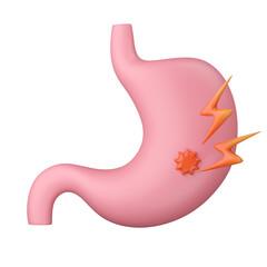 Stomach and Peptic ulcer disease 3D cartoon illustration