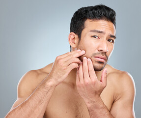 Naklejka premium Beauty, skincare and pimple with man in studio, facial and wellness on white background. Dermatology, fingers and hand for cosmetic acne for male person, dehydrated or selfcare for grooming treatment