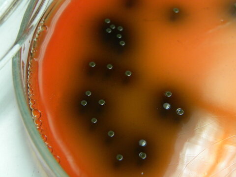 Listeria spp. colonies on Palcam medium, cultured by spread plate method. Listeria spp. form gray-green colonies with central depression (after 48 hours incubation) and black halo around colonies.