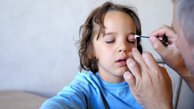 doctor treats an insect bite on a child's face with a cotton bud and allergy ointment, insect bite bruise under the eye, insect bite allergy 