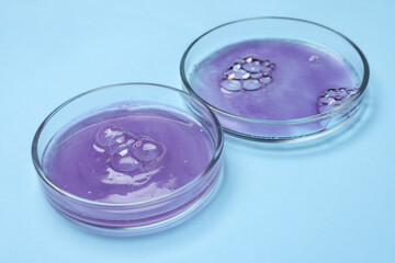 Petri dishes with samples on light blue background