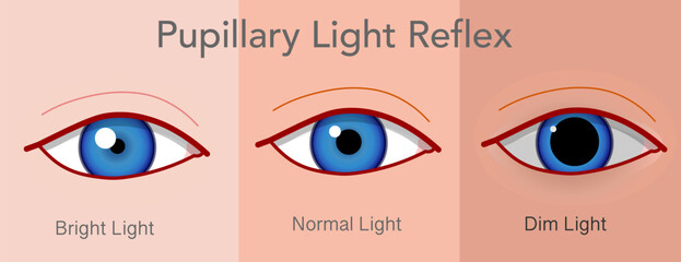 Pupillary light reflex eye, photopupillary. Big pupil dim bright light, small iris. Controls the diameter of the pupil when it is exposed to varying intensities of light. Vector illustration