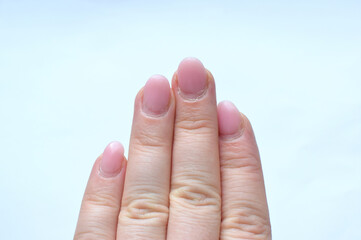 Overgrown manicure with gel and very dry cuticles. Female wrinkled hand with pink gel polish before correction in a beauty salon.