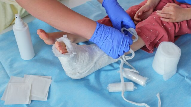 Registered Nurse Pediatritian Doctor Changing Dressing and Removing Medical Plaster Short Leg Orthopedic Cast during Treatment of Broken Ankle Injury of Caucasian Girl