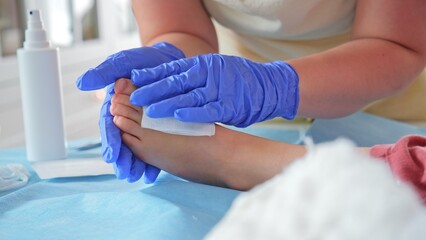 Registered Nurse Pediatritian Surgeon Doctor Treating Feet Injury Wound during Medical Procedure on...