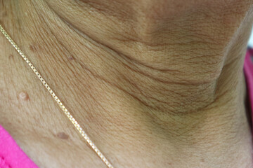 Aging skin folds or skin creases or wrinkles at neck of Southeast Asian, Indonesian old woman. Skin...