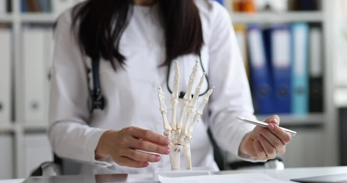 Doctor shows model of hand and bones of skeleton. Bone cysts and idiopathic aseptic necrosis of bone concept