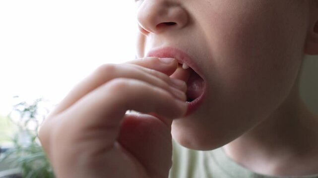 The child boy is shaking the front incisor tooth with his fingers. Loss of baby teeth.