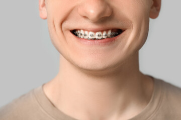 Obraz premium Smiling young man with dental braces on light background, closeup