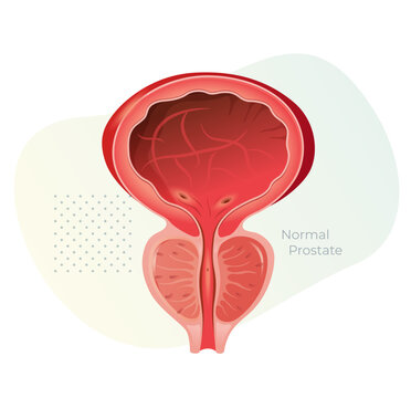 Normal Prostate Gland under Bladder - Stock Illustration