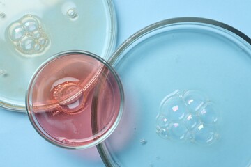Petri dishes with samples on light blue background, top view