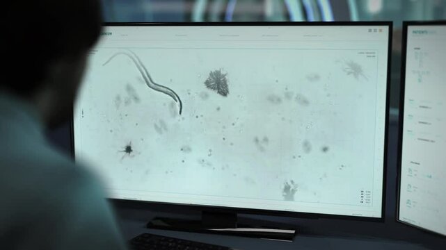 Parasite Worm Analysis Used In Parasitology Lab Research. Microscopic Parasite Worm Analysis In Innovative Scientific Software. Parasite Worm Microorganism Movement Analysis Process.