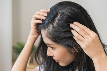 Damaged hair symptom, problem hair fall asian young woman, girl worry about balding, looking at scalp in mirror, hand in break into front hair loss, thin problem. Health care treatment for beauty.
