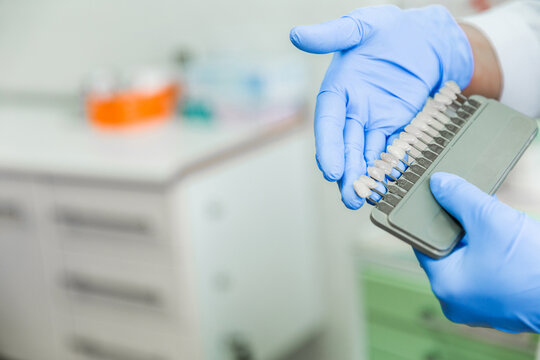 Dentist holding tooth shade guide in clinic